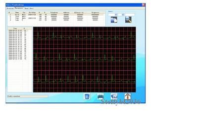 Portable Handheld ECG EKG Heart Monitor FDA Approved  