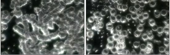 example of red blood cells. The picture on the left shows blood cells 